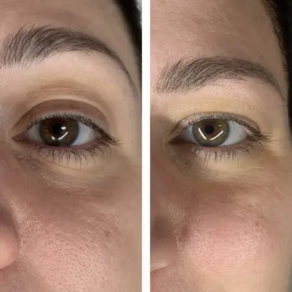 Beautifeye Cat Before And After2