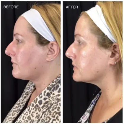 Screenshot 2023 06 22 At 16.21.42