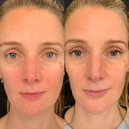 Agejet By Victoria 2