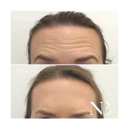 Before & Afters Dr Natasha 1