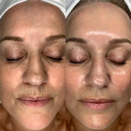 5A89b427 B1e3 4569 B846 4161Fb98c638