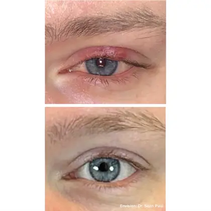 Envision Before And After 07 2 (1)