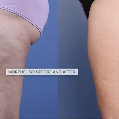 Screenshot 2023 05 23 At 13.53.15