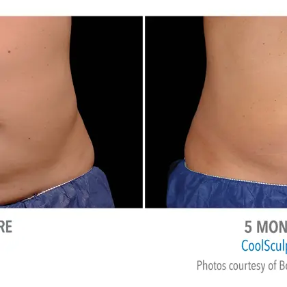 Fca2319f E2e0 4Ffb 8E94 D7aa6201766c Source V