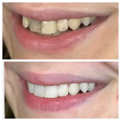 Facetune 23 12 2021 01 06 18