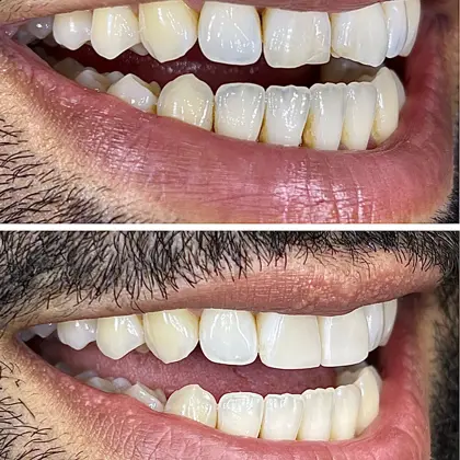 Dd5f6203 D9e6 413F A52b 38F5b754a4cd