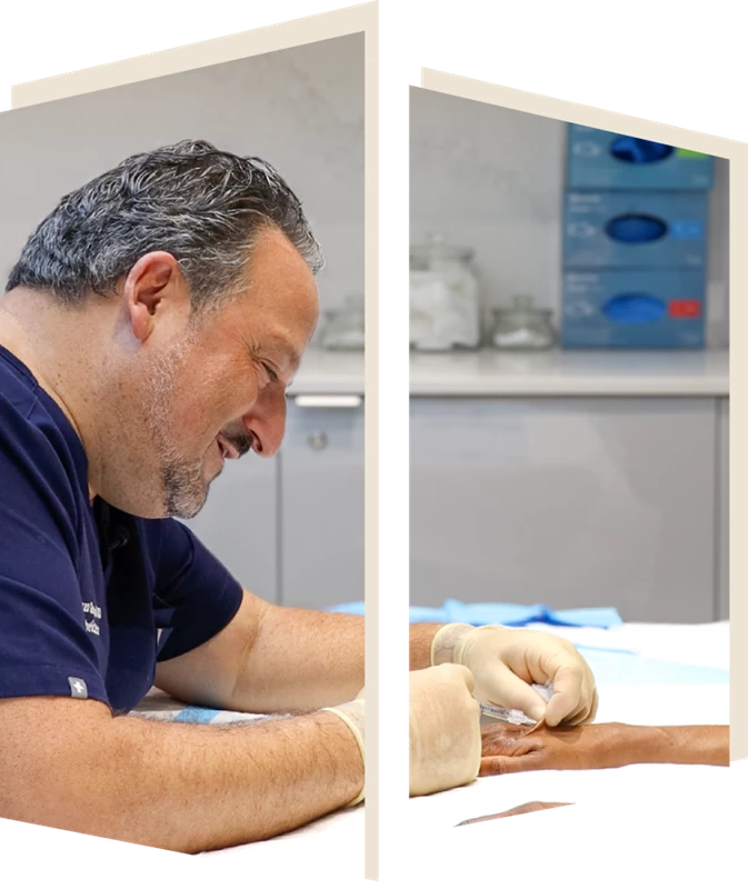 Hand Rejuvenation