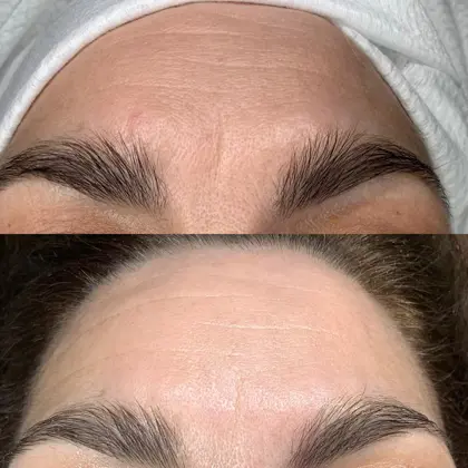 C183572a 5715 4195 B33b B3e5165a23c9