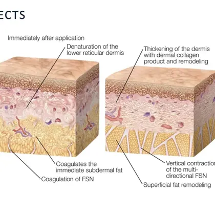 Screenshot 2023 05 22 At 14.06.00