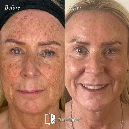 202607 Before and Afters, July 2026_Angela.jpg (1)