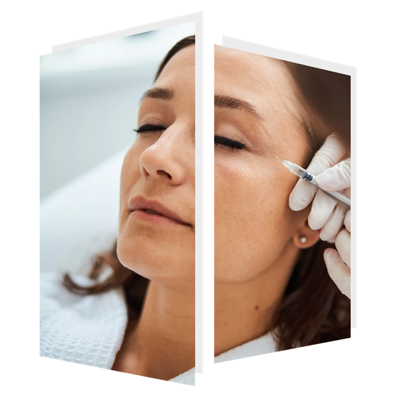 BeautifEYE Mesotherapy treatment at The Door