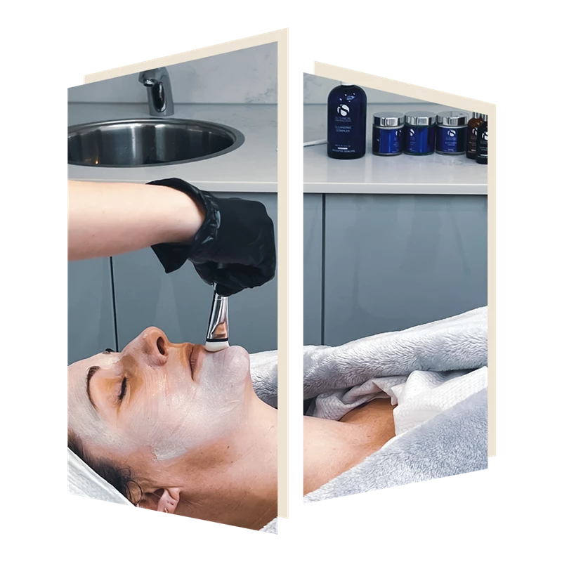 Fire and Ice facial at The Door W4