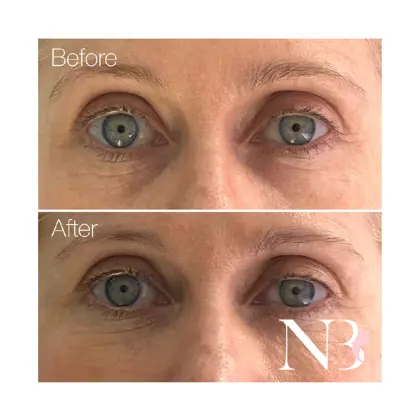 Before & Afters Dr Natasha 12