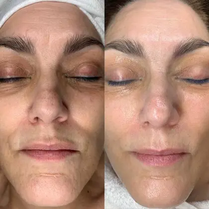 Cd925ca5 D2a0 4211 B9fb 8E3a8eca64f5