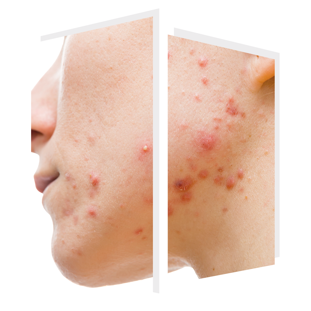 ClearSkin™ — The Door W4