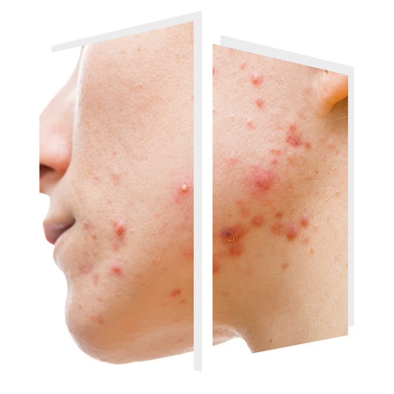 ClearSkin™ — The Door W4