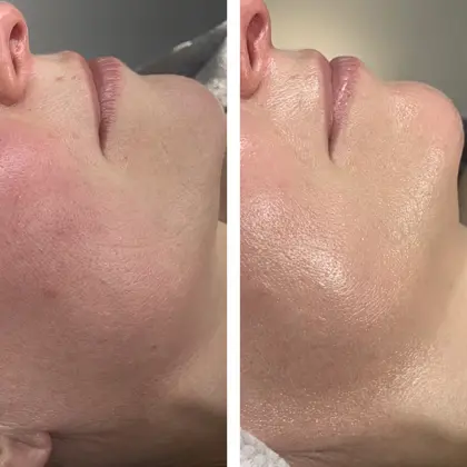 Fire And Ice Nic Chin Before And After