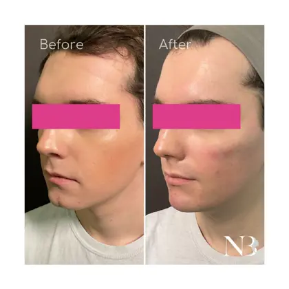 Before & Afters Dr Natasha 3