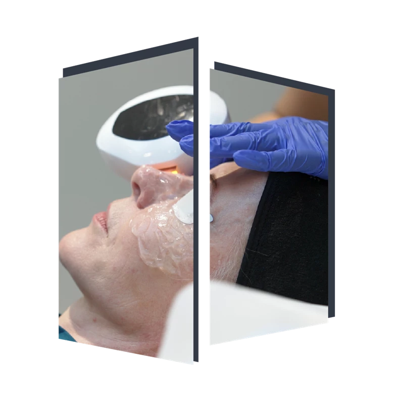 envision treatment