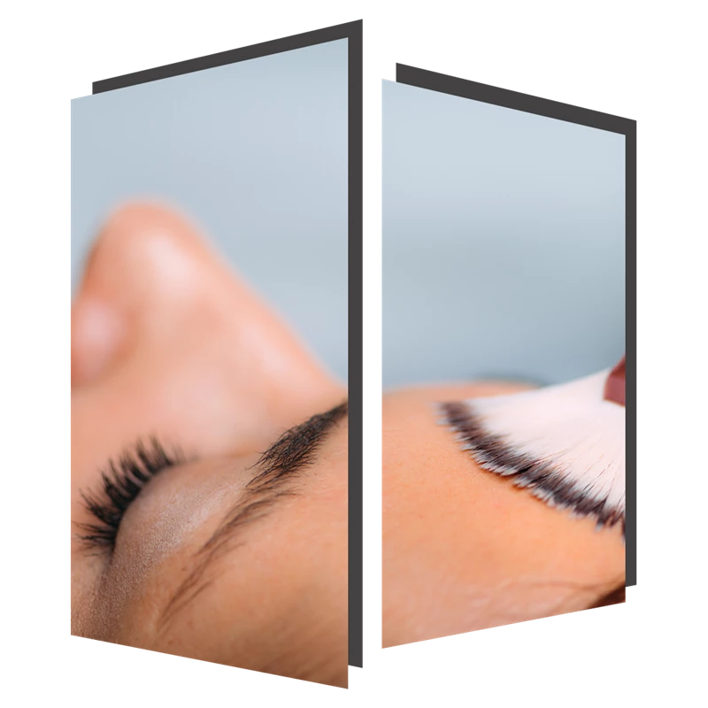 Chemical Peel