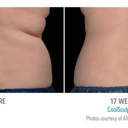 9A986a37 762F 4704 82E7 E6a0265a6312 Source V