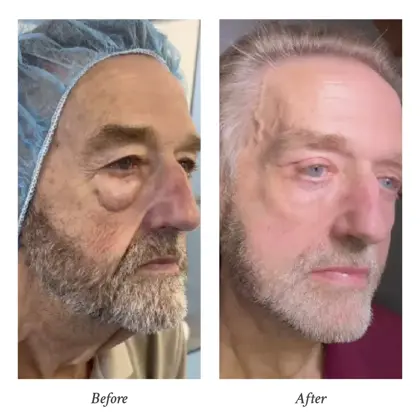 202603 Before and After (2) - Dr Kalin Tanov.jpg