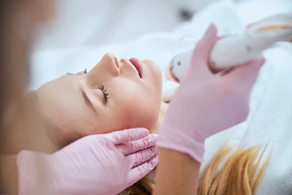 Microneedling