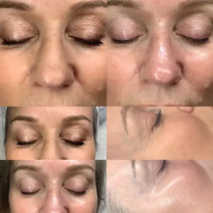 691E3EC6 3125 46F4 9250 CCA5AAFA59C1