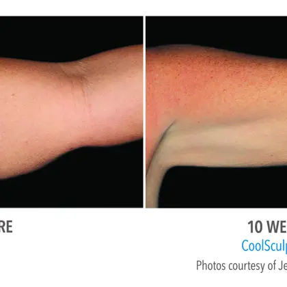 4E2171d5 Fc51 40Cf B4a1 E421f3120e88 Source V