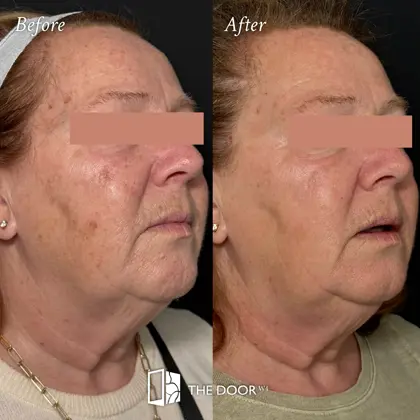 202607 Before and Afters, July 2026_Rachel.jpg (1)