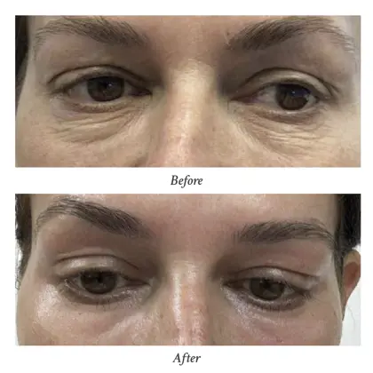 202603 Before and After (1) - Dr Kalin Tanov.jpg