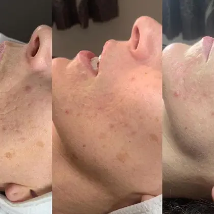 Lunchtime Peel Denise