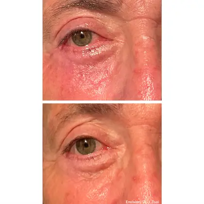 Envision Forma Before And After 05 2 (1)