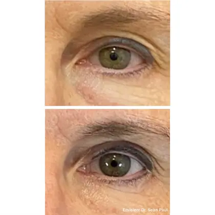 Envision Before And After 09 2 (1)